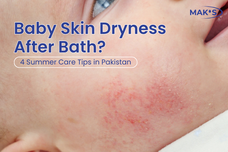 Baby Skin Dryness After Bath? 4 Summer Care Tips in Pakistan